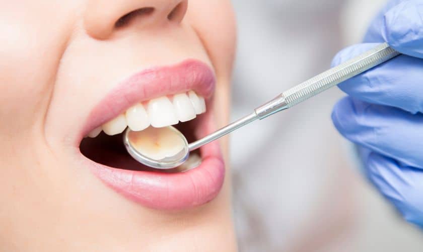 Dentist examining patient's teeth with mirror during dental checkup in clinical setting.