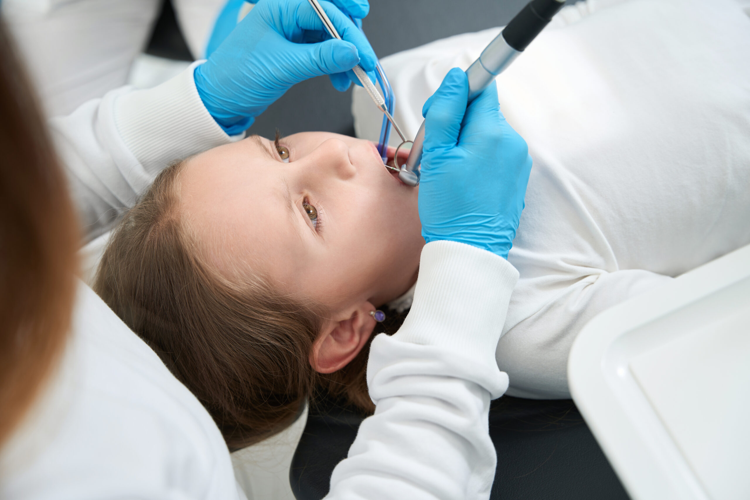 A child with brown hair is lying back in a dental chair, receiving dental care. A dentist in blue gloves uses tools in the child's open mouth.
