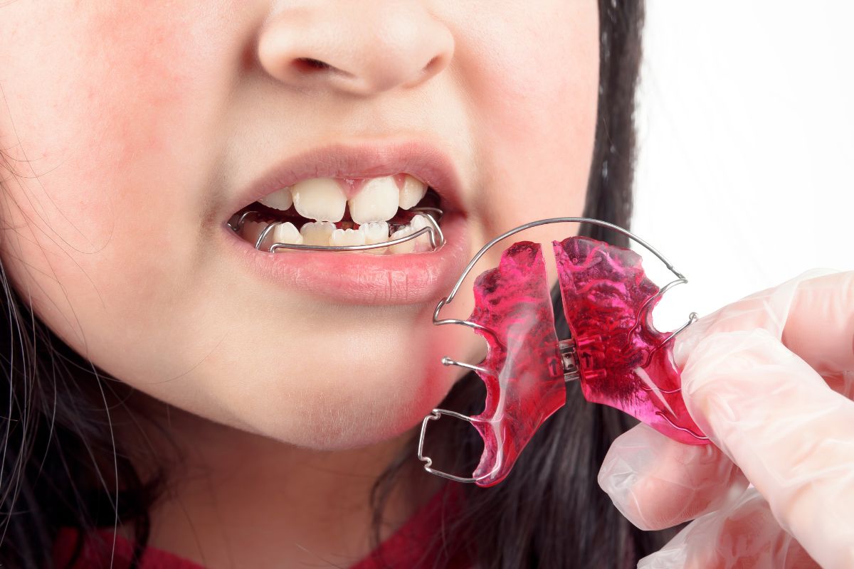 orthodontic-retention-after-braces-kids-retainers